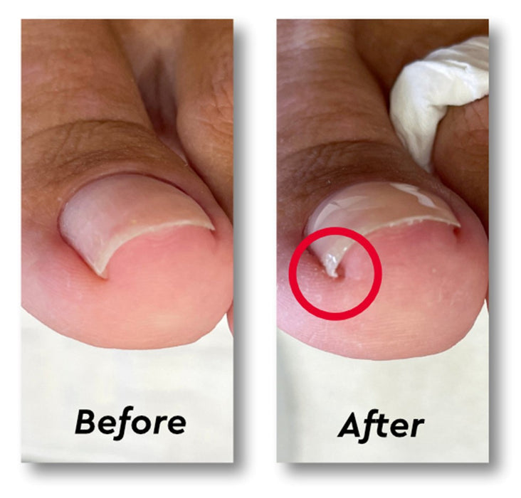 Lift Up Gel MVP
