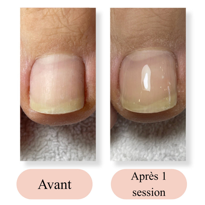 Lift Up Gel MVP